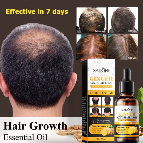 Sadoer gyömbéres hajhullás elleni szérum 30 ml SD40053