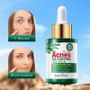 Sadoer akne elleni arcápoló szérum 30 ml SD42446